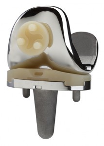 A200 Knee System with E-MAX Highly Crosslinked Polyethylene Tibial Insert and Patella